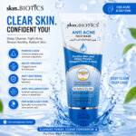 Anti Acne Face Wash